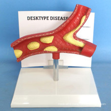 Human Pathological Vascular Medical Demonstration Model (R120109)